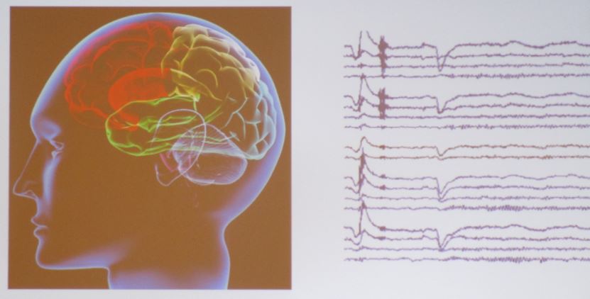 Neural substrates of the model components. Image courtesy of Sridevi Sarma.