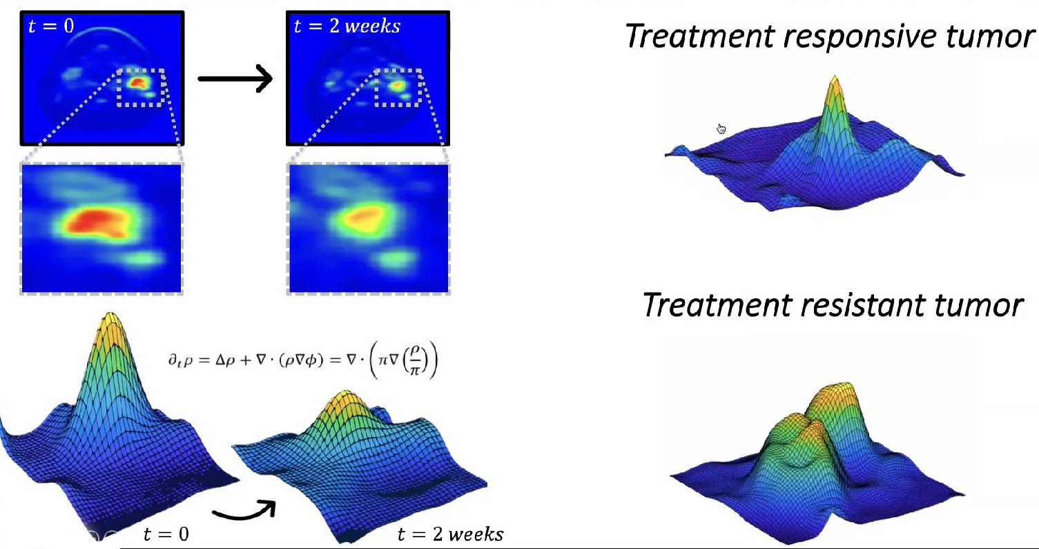 <strong>Figure 3.</strong> Projection of the tumor’s potential landscape before and after treatment, based on responsiveness to therapy.
