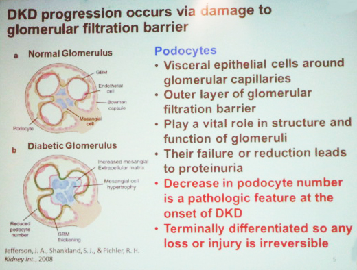 Progression of diabetic kidney disease occurs via damage to the glomerular filtration barrier. Image credit: Ashlee Ford Versypt, LS16 minisymposium presentation.