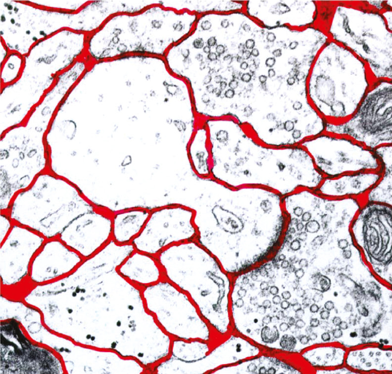 <strong>Figure 2.</strong> Cells in the brain lie in extracellular fluid (ECF). The fluid is coloured red. Image courtesy of [3].