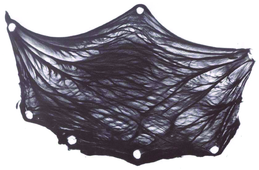 Image of an aortic valve leaflet stained for collagen, one of the three leaflets that regulates outflow from the left ventricle. It displays a branching and braided fiber architecture. Image Credit: A. Sauren.