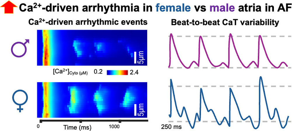 &lt;strong&gt;Figure 2.&lt;/strong&gt; Our computational simulations revealed heightened calcium (Ca&lt;sup&gt;2+&lt;/sup&gt;)-driven arrhythmic events and increased beat-to-beat variability of Ca&lt;sup&gt;2+&lt;/sup&gt; transient in female versus male atria with atrial fibrillation. Figure adapted from [10].