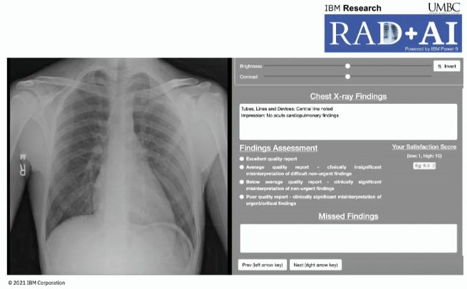 <strong>Figure 2.</strong> The interface for the Turing test in which senior radiologists evaluated reports created by the artificial intelligence platform and radiology residents. Figure courtesy of Tanveer Syeda-Mahmood.
