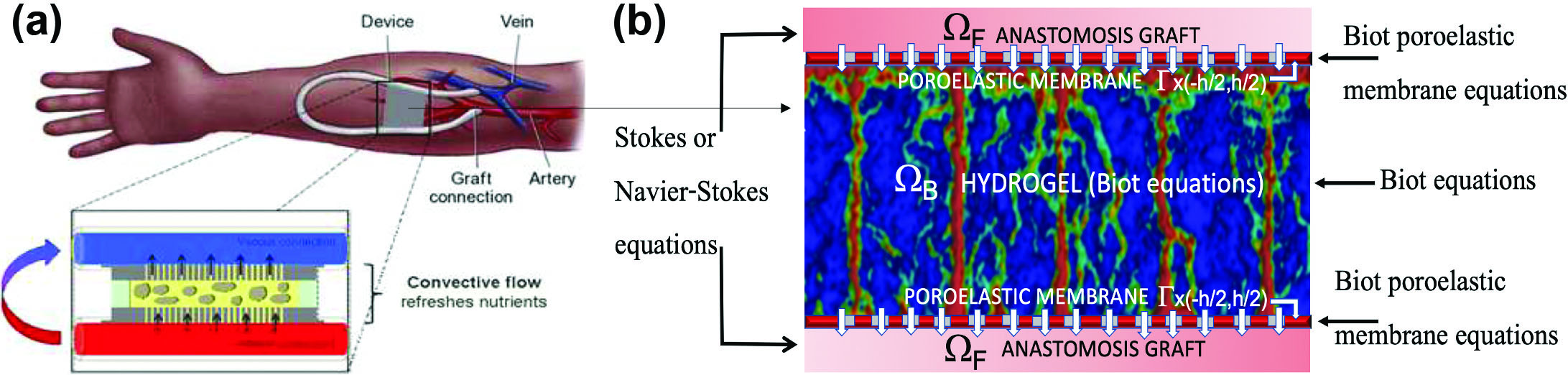<strong>Figure 1.</strong> A sketch of a bioartificial pancreas. <strong>1a.</strong> Schematic illustration of an anastomosis graft that connects the encapsulation device to the host vasculature. <strong>1b.</strong> Encapsulation device that depicts the poroelastic hydrogel scaffold, encapsulating membranes, and part of the anastomosis graft. Figure 1a courtesy of Shuvo Roy and 1b courtesy of Sunčica Čanić.