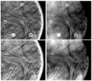 Reconstructions of phantom breast objects. The top row contains circular lesions of increasing glandular fraction, and the bottom row contains microcalciﬁcations. Image credit: Veronica Mejia Bustamante, James Nagy, Steve Feng, and Ioannis Sechopoulos
