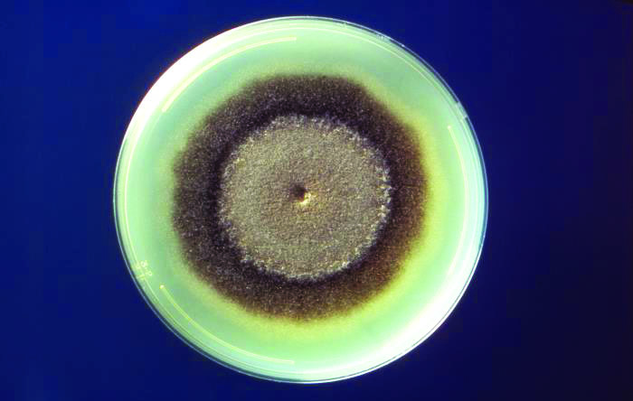 <strong>Figure 1.</strong> Petri dish culture of the fungus <em>Exserohilum rostratum</em>, which exhibits concentric growth patterns that are particularly noticeable because of how the cells change color as they age. Public domain image courtesy of the Centers for Disease Control and Prevention/Libero Ajello.