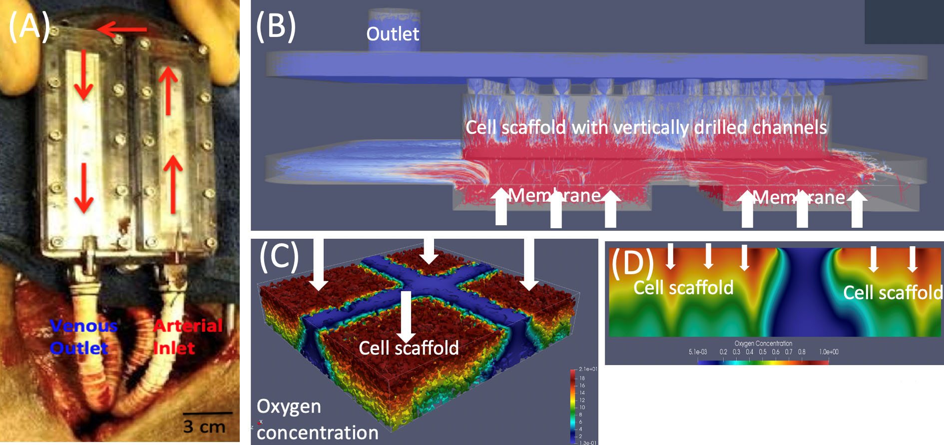 <strong>Figure 2.</strong> Implantable bioartificial pancreas (iBAP). <strong>2a.</strong> The iBAP prototype device in a porcine model. <strong>2b.</strong> Streamlines that depict flow direction and magnitude. Red indicates a high level of flow, and white and blue indicate low levels. <strong>2c.</strong> A three-dimensional (3D) simulation of oxygen concentration in the scaffold. Red signifies a high level of oxygen, and cyan and blue signify low levels. <strong>2d.</strong> A two-dimensional slice of the 3D simulation in 2c. White arrows denote flow direction. Figure 2a courtesy of Shuvo Roy and 2b-2d courtesy of Sunčica Čanić.