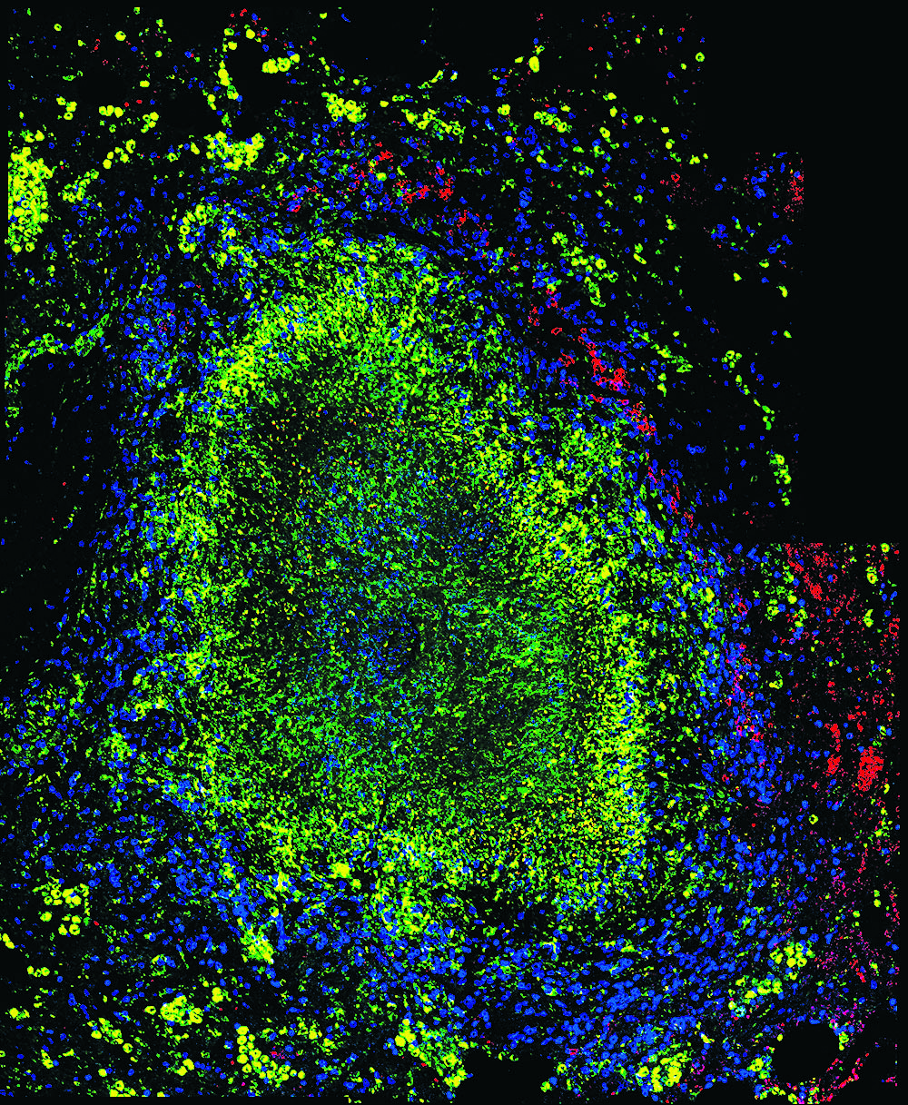 <strong>Figure 1.</strong> Non-human primate granuloma. Figure courtesy of the laboratory of JoAnne Flynn at the University of Pittsburgh.