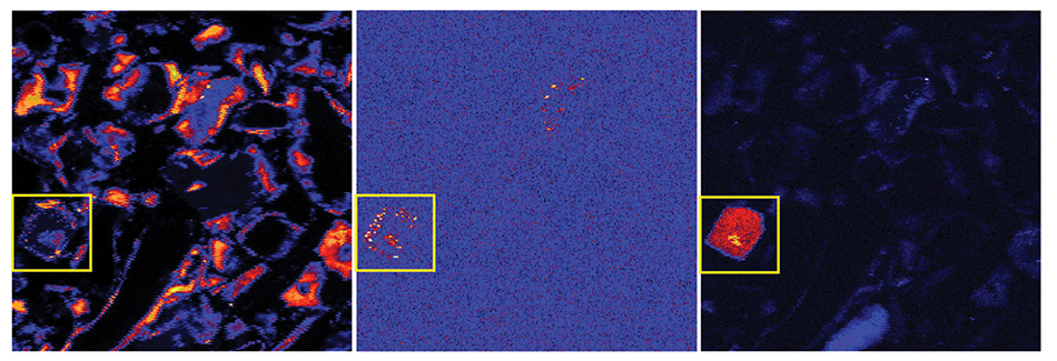 <strong>Figure 1.</strong>  Selected element distribution maps (iron, left; arsenic, center; uranium, right) for sample Roadcut Lithosome A illustrating that As and U trend with Fe (since they appear to be associated with iron-bearing minerals in the clay) in this portion of the Chimayo sediment.  A yellow box has been drawn around an area of interest in these false-color maps (in which warmer colors correspond to higher concentrations of each element). Maps were collected at 19 keV with a step size of 2 µm. Each map area is 500 µm x 500 µm.