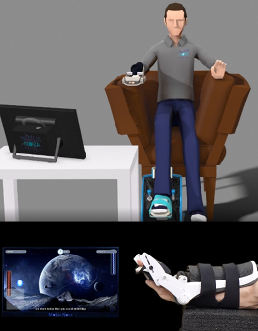 <strong>Figure 1.</strong> Motus Nova’s in-home robotics-assisted therapy setup offers an apparatus for both the hand and foot. Figure courtesy of Russell Jeter/<a href="https://motusnova.com/" target="_blank">Motus Nova</a>.