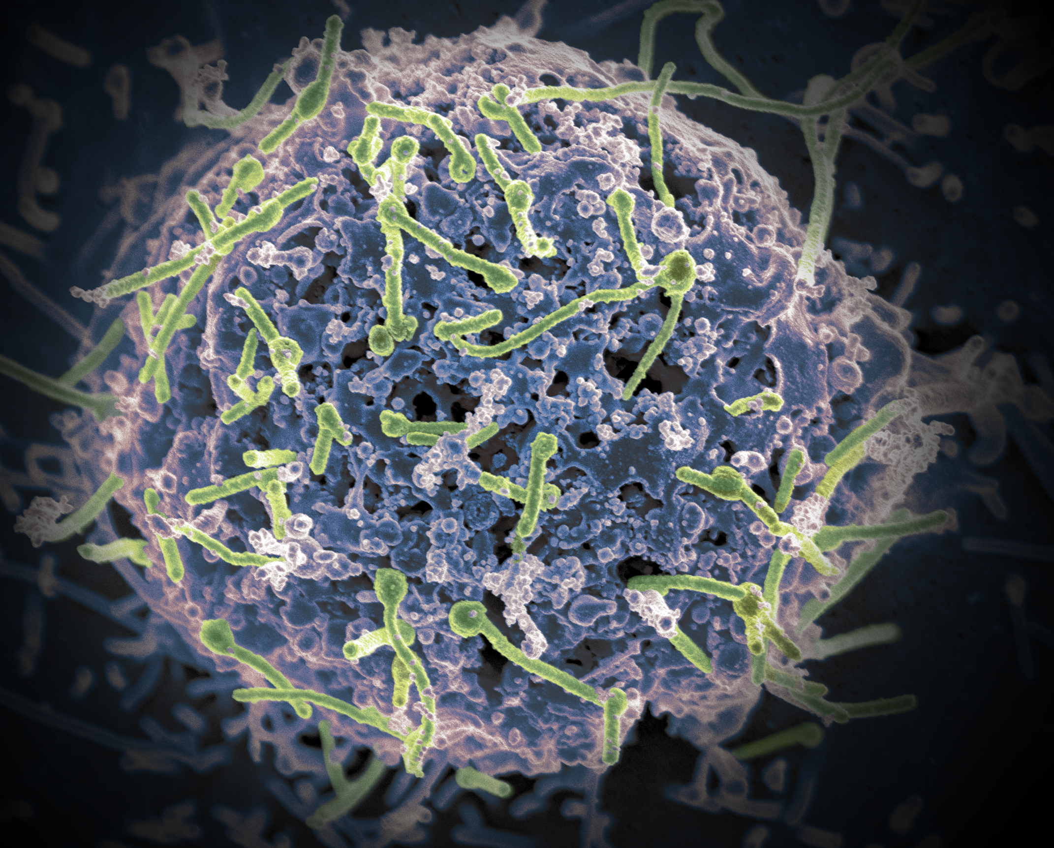 Ebola spreads via direct contact with an infected patient's bodily fluids. Image credit: Wikimedia Commons.