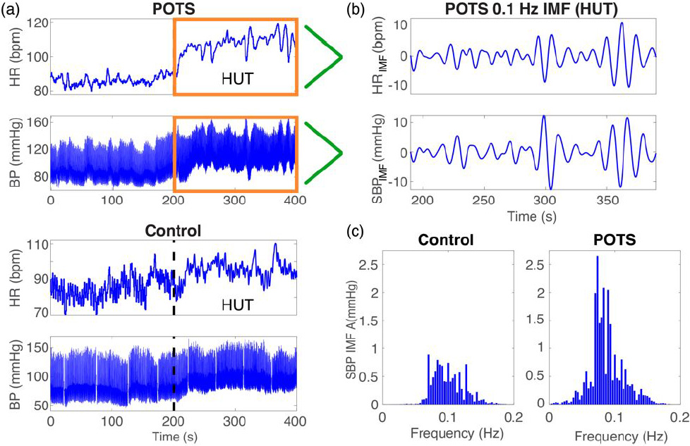 <strong>Figure 1.</strong> Signal processing pipeline. <strong>1a.</strong> Heart rate (HR) and blood pressure (BP) time-series data from a POTS (top) and control (bottom) subject at rest (\(𝑡 < 200\) s) and after head-up tilt (HUT) (\(𝑡 > 200\) s). <strong>1b.</strong> HR and systolic BP low-frequency intrinsic mode functions (IMFs). <strong>1c.</strong> The power of the IMF 0.1 Hz signal during HUT for the control (left) and POTS (right) subject. Figure courtesy of the authors.