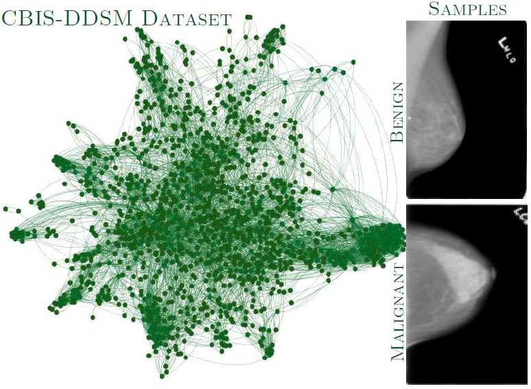 &lt;strong&gt;Figure 3.&lt;/strong&gt; Graph visualization of the Curated Breast Imaging Subset of the Digital Database for Screening Mammography (CBIS-DDSM). Figure courtesy of [1].
