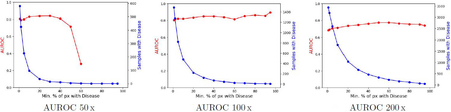<strong>Figure 5.</strong> Area under the receiver operating characteristic curve (AUROC) scores (red) for the distinction between healthy tissue and actinic keratosis (AK) at three different magnification levels: 50x, 100x, and 200x. The values are plotted against the respective area thresholds for assignment of image patches to the AK class. The number of diseased samples according to this threshold is shown in blue. Figure courtesy of Maximilian Schmidt.