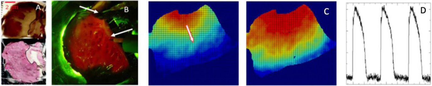 <strong>Figure 1.</strong> Fluorescence optical mapping of cardiac electrical activation. <strong>1a.</strong> Canine right ventricle visualization from top and bottom with two optical mapping cameras. <strong>1b.</strong> Tissue is loaded with voltage dye and illuminated with green light. <strong>1c.</strong> Example of an action potential (transmembrane voltage) wave measured with optical mapping. <strong>1d.</strong> Optical mapping voltage signal from a single pixel. Figure courtesy of Flavio Fenton and [2].
