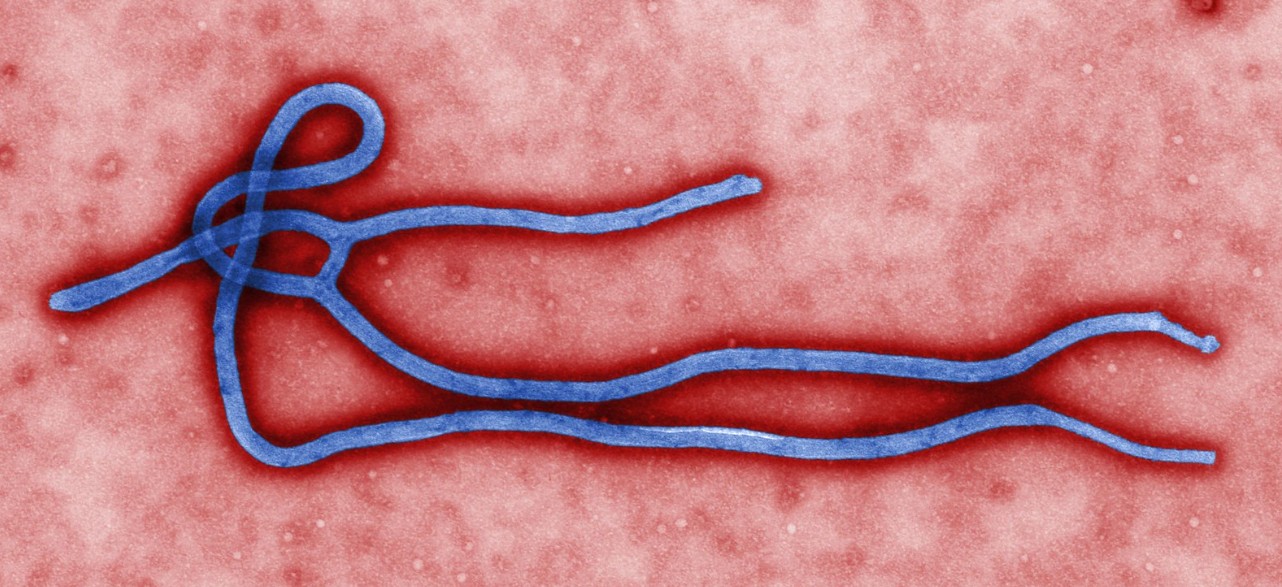 <strong>Figure 1.</strong> Electron micrograph of an ebolavirus virion. Public domain image courtesy of the U.S. Centers for Disease Control and Prevention's <a href="https://phil.cdc.gov/default.aspx" target="_blank">Public Health Image Library</a>.