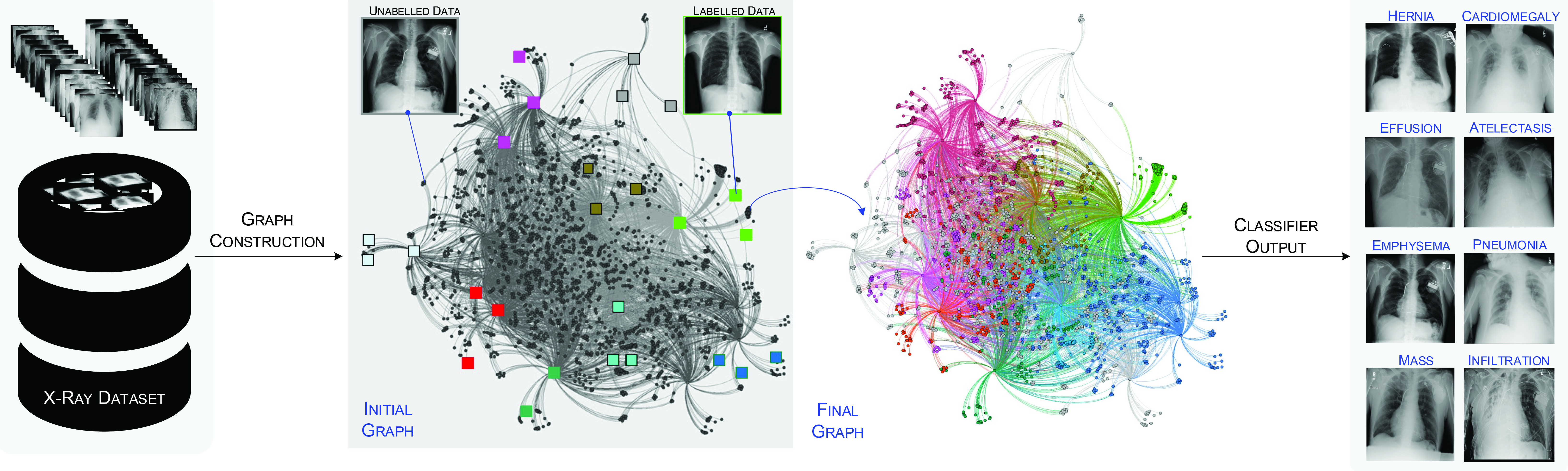 <strong>Figure 1.</strong> Graph-based classification of chest X-rays into different pathologies. Based on only a very small number of labeled X-rays per class, researchers aim to classify the rest. To do so, they map the X-rays into a high-dimensional feature space where known labels are propagated to the unlabeled X-rays by the graph Laplacian. Figure courtesy of [1].
