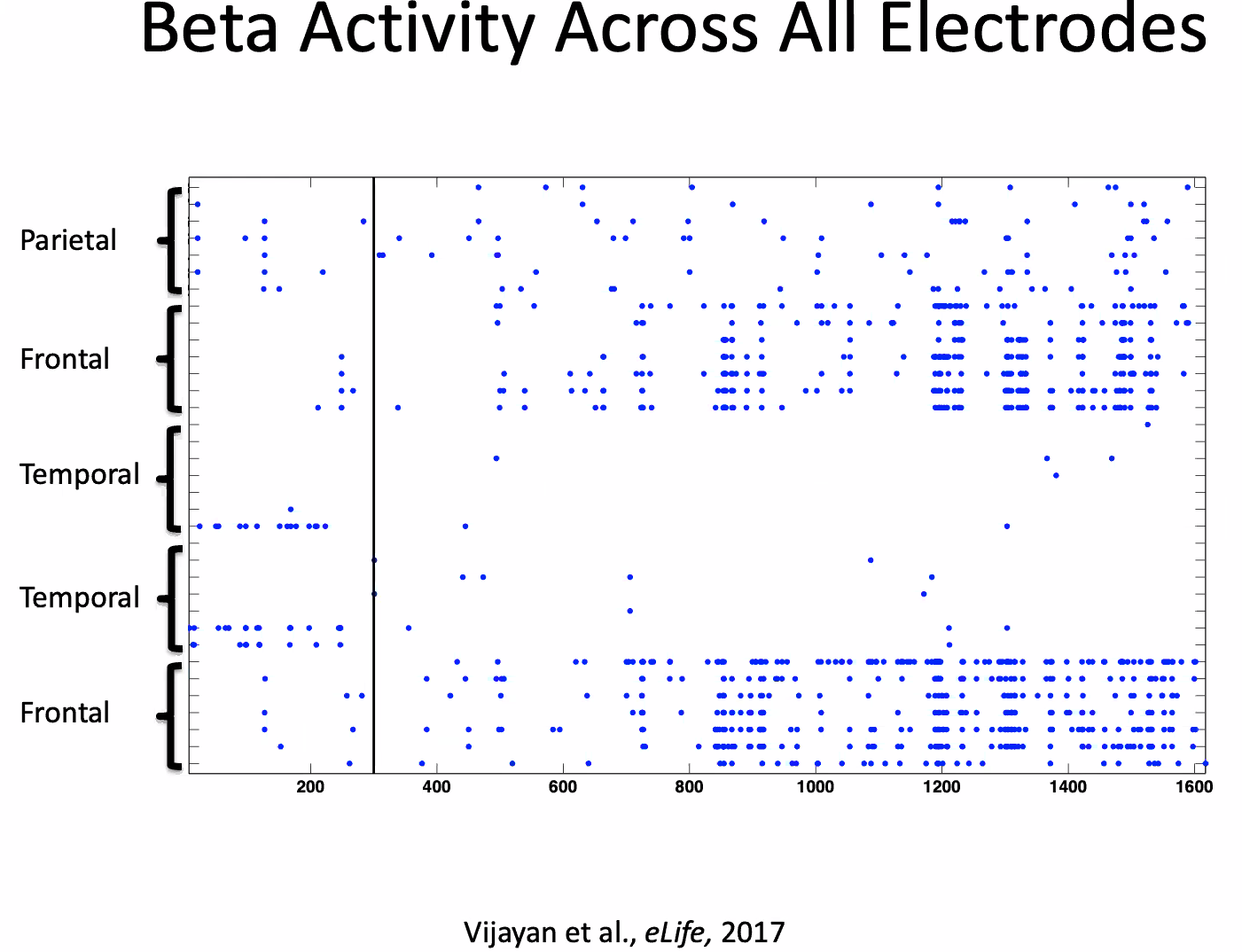 Vijayan compared the patterns of beta activity in different regions of the brain.