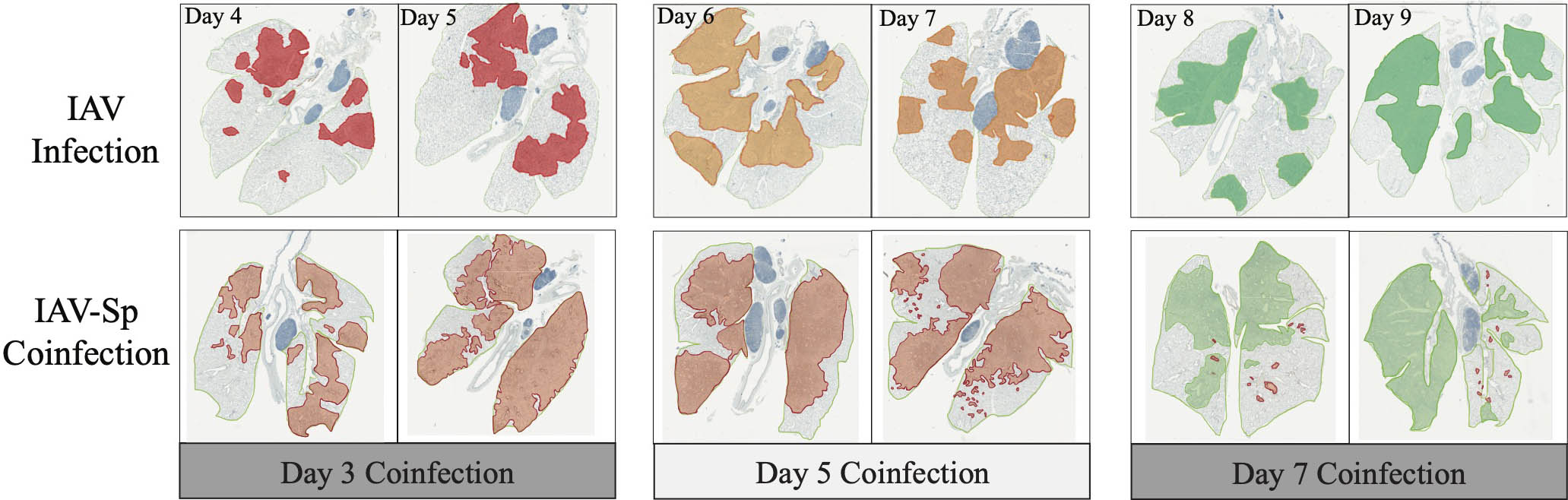 &lt;strong&gt;Figure 1.&lt;/strong&gt; Whole lung sections with histomorphometry from mice that were infected with influenza (top), or infected with pneumococcus at three, five, or seven days after influenza (bottom). The influenza-positive areas are red, the areas where resolution has begun are orange, and the areas that were previously infected are green. Figure courtesy of [2].
