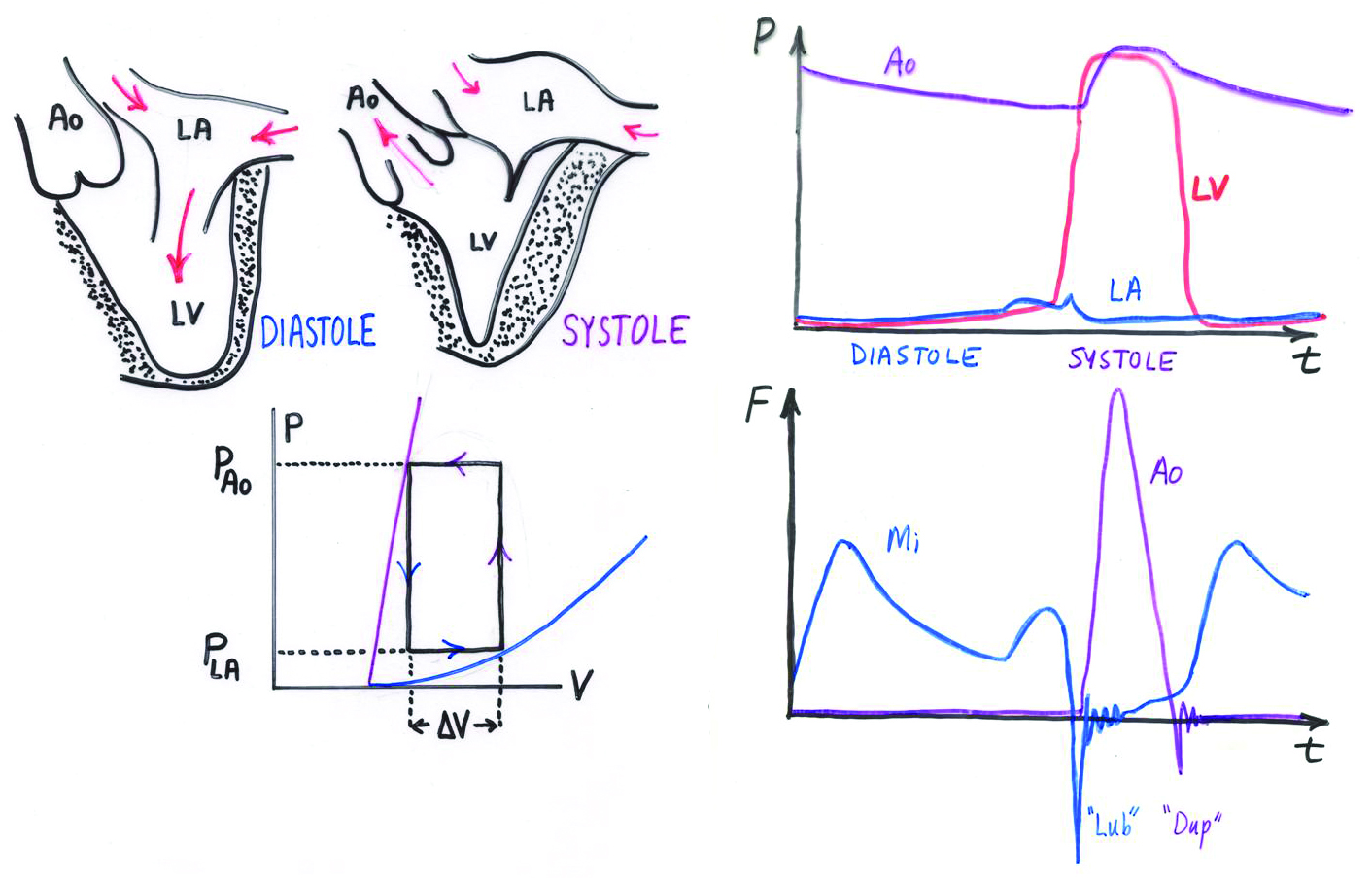 <strong>Figure 1.</strong> Diagram showing the physiology of the left side of the heart. The right heart is qualitatively the same but quantitatively different. <strong>Upper left.</strong> Heart in its two main states, diastole (relaxed) and systole (contracted). LA=left atrium, LV=left ventricle, Ao=aorta. <strong>Bottom left.</strong> Pressure/volume diagram of the cardiac cycle. Each corner of the rectangular path denotes the opening or closing of a valve. Inflow and outflow pressures are idealized as constant. ∆V denotes the stroke volume. <strong>Upper right.</strong> Pressures in the Ao, LV, and LA. The ventricle switches between atrial pressure when relaxed and aortic pressure when contracted. <strong>Bottom right.</strong> Flows through the Ao and mitral (Mi) valves, with the heart sounds indicated. Image credit: Charles Peskin.