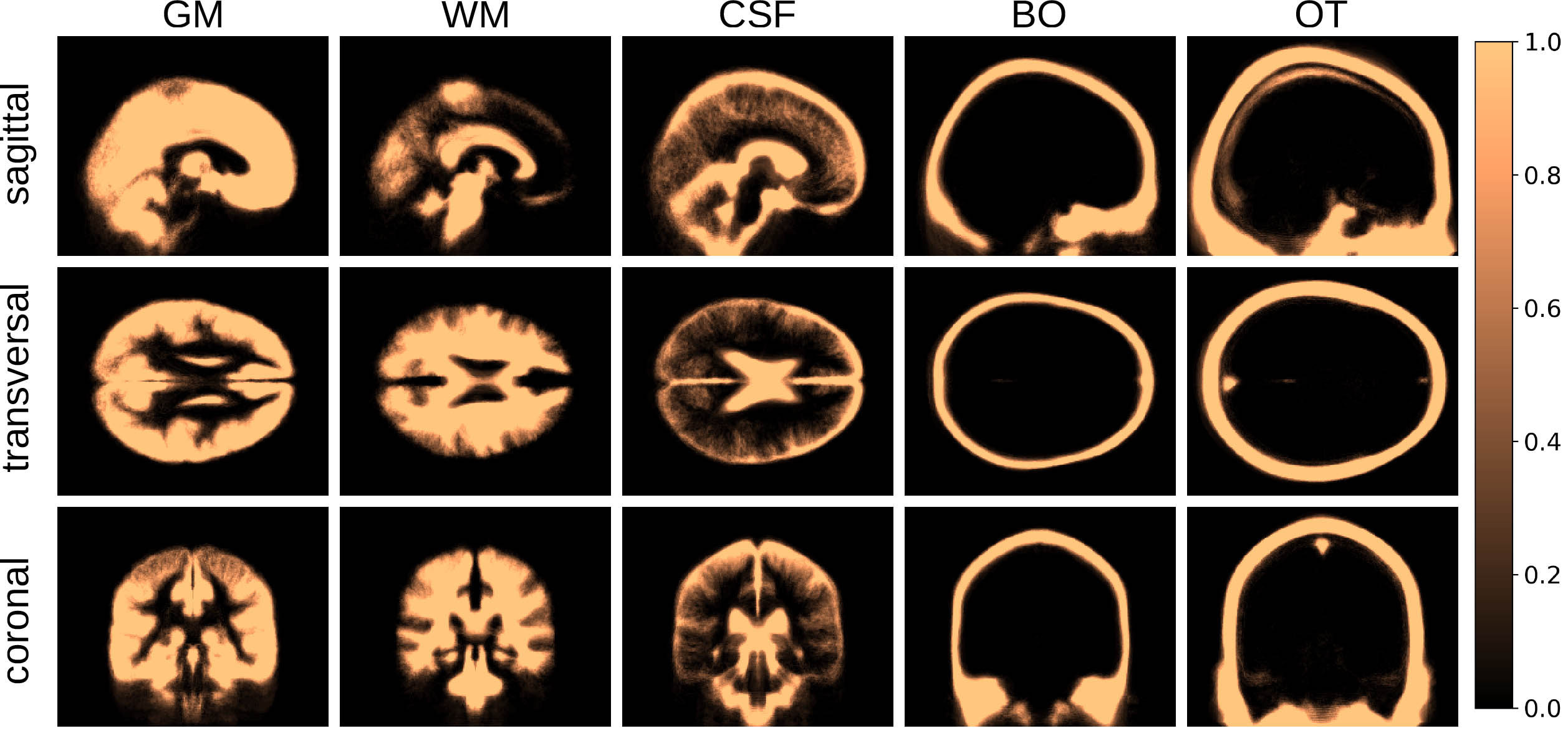 <strong>Figure 2.</strong> The average results from segmenting all of the images into gray matter (GM), white matter (WM), cerebrospinal fluid (CSF), bones (BO), and other soft tissues (OT). The information in the atlas is three-dimensional, but this figure provides two-dimensional images from the coronal, transversal, and sagittal viewpoints. Figure courtesy of Fernando Moura.