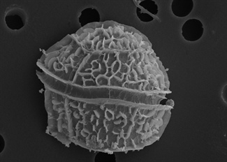 Scanning electron microscope image of a dinoflagellate. Image credit: Wikipedia