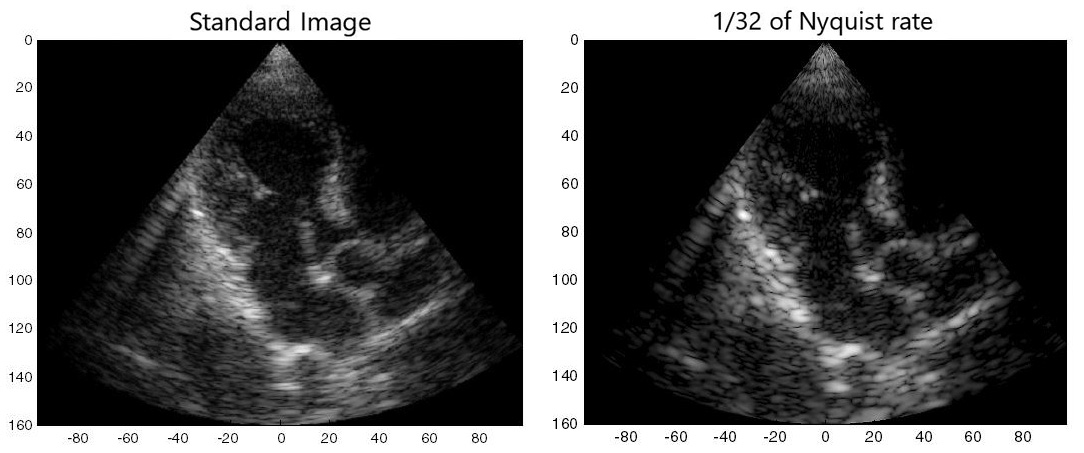 &lt;strong&gt;Figure 3.&lt;/strong&gt; Ultrasound imaging at three percent of the Nyquist rate (right), as compared to a standard image (left). Image courtesy of [1].