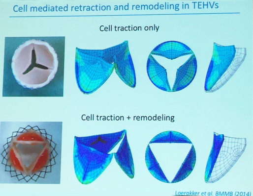 Cell-mediated retraction and remodeling in TEHVs. Image credit: Frank Baaijens, AN16 presentation.