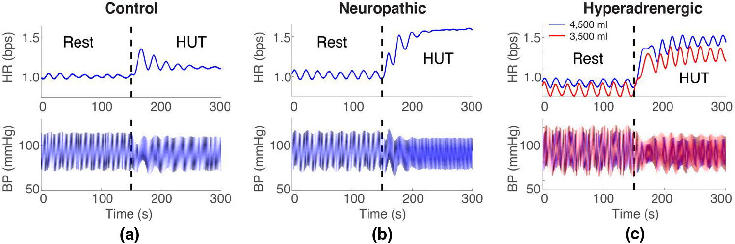 <strong>Figure 3.</strong> Model simulations for a (<strong>3a</strong>) control subject, (<strong>3b</strong>) neuropathic POTS patient, and (<strong>3c</strong>) hyperadrenergic POTS patient with a central blood volume of 4,500 ml (blue) and 3,500 ml (red). Figure courtesy of the authors.