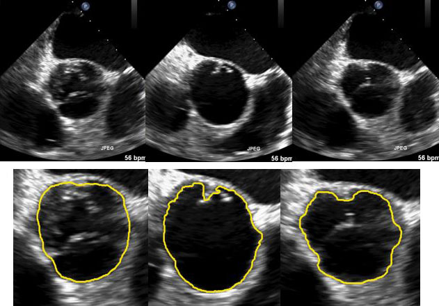 Selected frames of the original ultrasound images (left to right) and the regions of interest (ROI) tracking results (top to bottom). Photo credit: Xiaoqun Zhang.