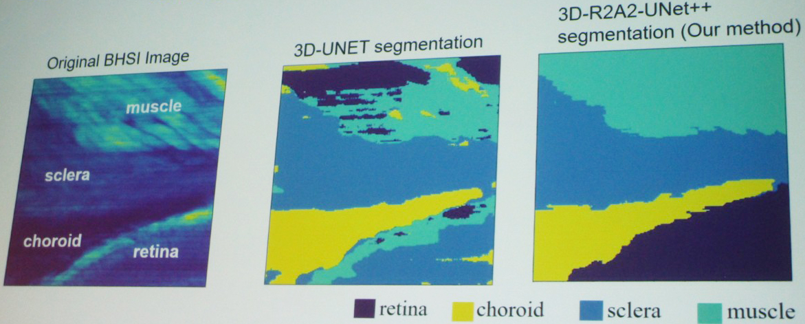 <strong>Figure 2.</strong> Visual comparison of segmentation results between an original biomedical hyperspectral fluorescence image, three-dimensional (3D)-UNET segmentation, and Na Yu’s 3D-R2A2UNet++ segmentation. Figure courtesy of Na Yu.