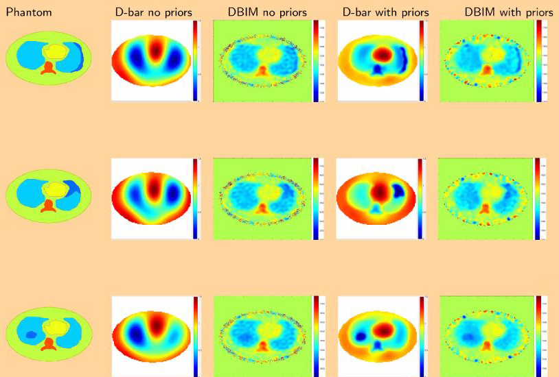 <strong>Figure 2.</strong> Results of the sound speed phantoms for the small pneumothorax (top), larger pneumothorax (middle), and air trapping (bottom). Left to right: true organ boundaries for the phantom, standard EIT (D-bar) reconstruction with no priors, ultrasound reconstruction (DBIM) with no priors, D-bar reconstruction with priors, and DBIM with priors.