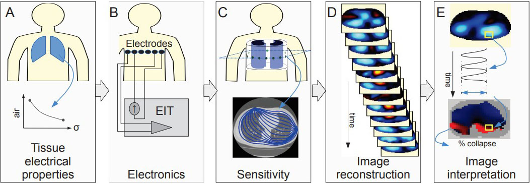 &lt;strong&gt;Figure 1.&lt;/strong&gt; Overview of electrical impedance tomography (EIT) and the resulting image generation and interpretation process. Figure courtesy of [1].